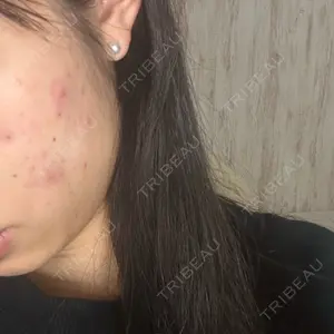 MKクリニック 日本橋院口コミ