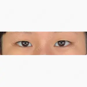 アリエル美容クリニック 郡山院口コミ