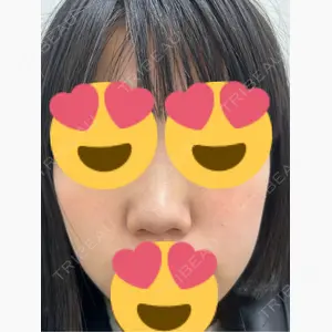 ゆう美容クリニック口コミ