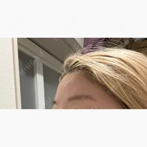 HAAB×DREAM BEAUTY CLINIC 東京本院口コミ