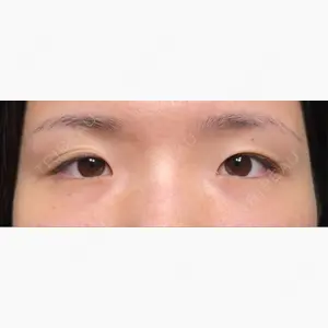 HAAB×DREAM BEAUTY CLINIC 大阪梅田院口コミ