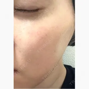 LiLAスキンクリニック中目黒口コミ