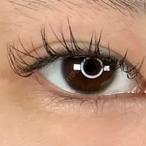 アリエル美容クリニック 郡山院口コミ