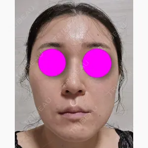 東京シンデレラ美容外科 池袋院口コミ