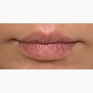 NEXUS CLINIC口コミ