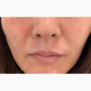 eクリニック 福岡院口コミ