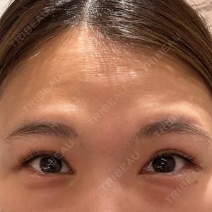 HAAB×DREAM BEAUTY CLINIC 大阪梅田院口コミ