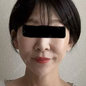 TCB東京中央美容外科 徳島院口コミ