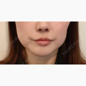 THE CLINIC（ザ・クリニック） 大阪院口コミ