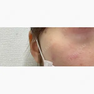 Mavie Beauty Clinic （マヴィービューティークリニック）口コミ