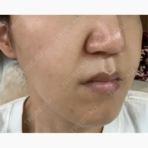 つつじクリニック Akasaka口コミ