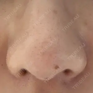 シエルクリニック口コミ