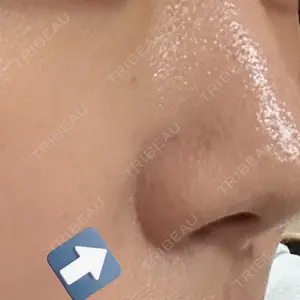 HAAB BEAUTY CLINIC 名古屋院口コミ