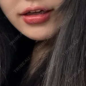 TCB東京中央美容外科 青森院口コミ