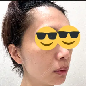 Zetith Beauty Clinic 新宿院口コミ