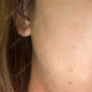 ルラ美容クリニック 名古屋栄院 / ルラスキンクリニック 名古屋栄院口コミ