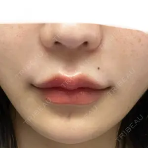 東京美容医療クリニック 池袋院口コミ