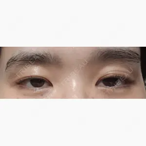 PRO CLINIC プロクリニック 銀座院口コミ