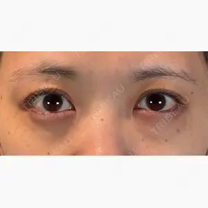 アリエル美容クリニック 郡山院口コミ