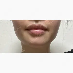 TCB東京中央美容外科 自由が丘院口コミ