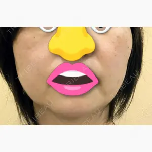 ルラ美容クリニック 静岡院口コミ