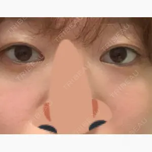 9BeautyClinic口コミ