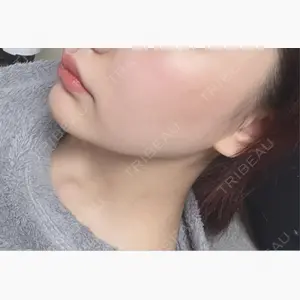 札幌美容外科ネビュラクリニック口コミ