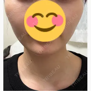 東京ココセランクリニック口コミ