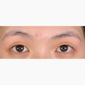 アリエル美容クリニック 郡山院口コミ