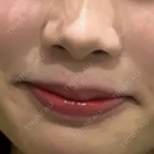 小倉美容外科/美容皮膚科 ビラビューティークリニック口コミ