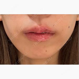 HAAB×DREAM BEAUTY CLINIC 大阪梅田院口コミ