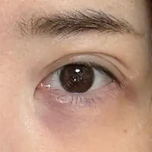 ルラ美容クリニック 渋谷本院口コミ