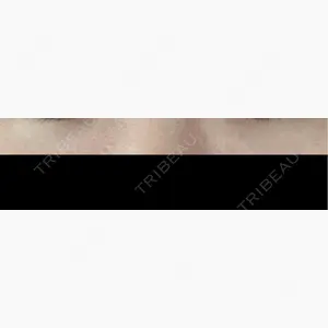 共立美容外科 梅田院口コミ