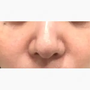 湘南美容クリニック 博多院口コミ