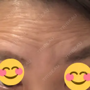 PRO CLINIC プロクリニック 銀座院口コミ