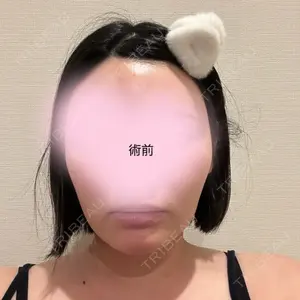 脂肪吸引の森クリニック東京院口コミ