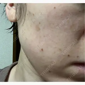 ルラ美容クリニック 仙台院 / ルラスキンクリニック 仙台院口コミ