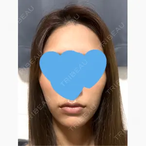 PRO CLINIC プロクリニック 銀座院口コミ