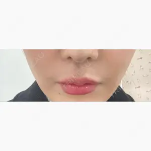 ルラ美容クリニック 福岡本院口コミ