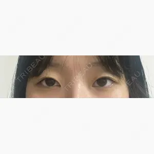 LUHO（ルホ）美容外科口コミ