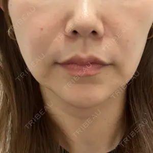 DMTC CLINIC 日本橋院口コミ