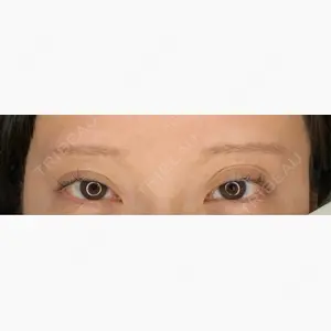 design beauty clinic 梅田本院口コミ