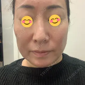 TCB東京中央美容外科 銀座有楽町院口コミ