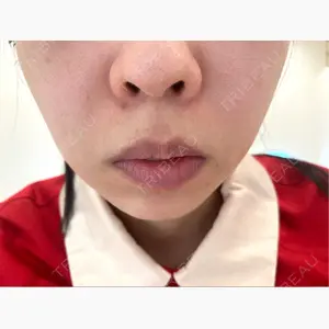 ルラ美容クリニック 福岡天神院口コミ