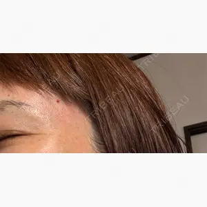 ルラ美容クリニック 広島院口コミ