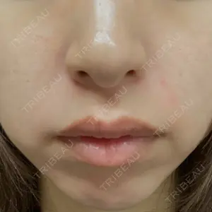 エースクリニック 大阪梅田HEPナビオ院口コミ