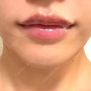 プライベートスキンクリニック 梅田本院口コミ