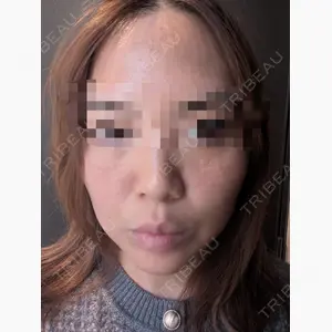 AB美容クリニック 新宿院口コミ