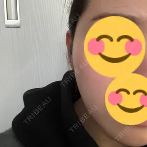 TCB東京中央美容外科 横浜院口コミ