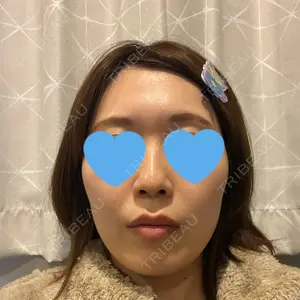 あいちビューティークリニック栄本院口コミ